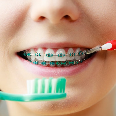 Icon Treatment Mattioli Orthodontics in East Greenwich, RI